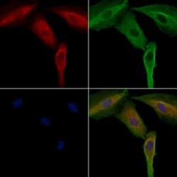 Invitrogen SIK3 Polyclonal Antibody 100 &mu;L; Unconjugated:Antibodies,