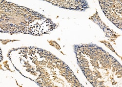 RAB11FIP1 Polyclonal Antibody, Invitrogen&trade;