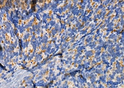 RAB11FIP1 Polyclonal Antibody, Invitrogen&trade;