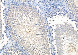 RAB11FIP1 Polyclonal Antibody, Invitrogen&trade;
