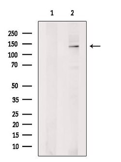 RAB11FIP1 Polyclonal Antibody, Invitrogen™