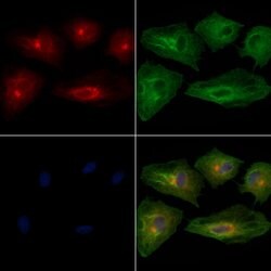 Invitrogen RAB17 Polyclonal Antibody 100 μL; Unconjugated:Antibodies,