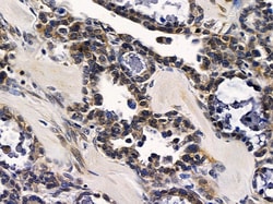 Invitrogen RAB17 Polyclonal Antibody 100 μL; Unconjugated:Antibodies,