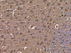 Invitrogen RAB17 Polyclonal Antibody 100 μL; Unconjugated:Antibodies,