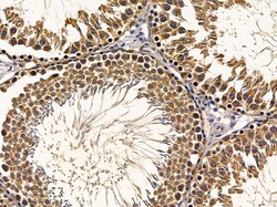 Invitrogen RAB17 Polyclonal Antibody 100 μL; Unconjugated:Antibodies,