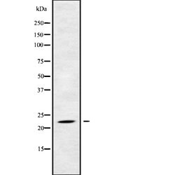 Invitrogen RAB17 Polyclonal Antibody 100 μL; Unconjugated:Antibodies,