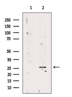 Invitrogen RAB23 Polyclonal Antibody 100 μL; Unconjugated:Antibodies,