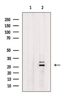 RAB29 Polyclonal Antibody:Antibodies, Polyclonal
