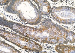 Invitrogen RARRES3 Polyclonal Antibody 100 &mu;L; Unconjugated:Antibodies,
