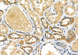 Invitrogen RARRES3 Polyclonal Antibody 100 &mu;L; Unconjugated:Antibodies,