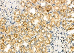 Invitrogen RARRES3 Polyclonal Antibody 100 &mu;L; Unconjugated:Antibodies,