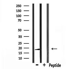 Invitrogen RARRES3 Polyclonal Antibody 100 &mu;L; Unconjugated:Antibodies,