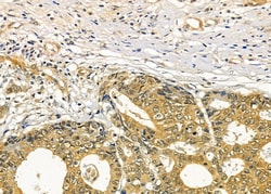 Invitrogen RASA4 Polyclonal Antibody 100 &mu;L; Unconjugated:Antibodies,