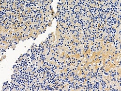 Invitrogen RASGRF2 Polyclonal Antibody 100 &mu;L; Unconjugated:Antibodies,