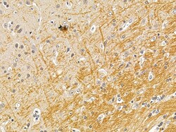 Invitrogen RASGRF2 Polyclonal Antibody 100 &mu;L; Unconjugated:Antibodies,