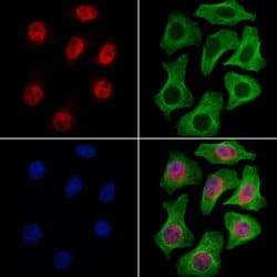 Invitrogen RECQL5 Polyclonal Antibody 100 &mu;L; Unconjugated:Antibodies,