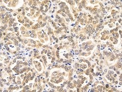 Invitrogen RECQL5 Polyclonal Antibody 100 &mu;L; Unconjugated:Antibodies,