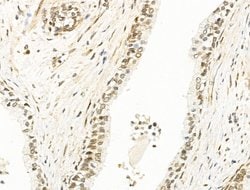 Invitrogen RECQL5 Polyclonal Antibody 100 &mu;L; Unconjugated:Antibodies,
