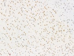 Invitrogen RECQL5 Polyclonal Antibody 100 &mu;L; Unconjugated:Antibodies,