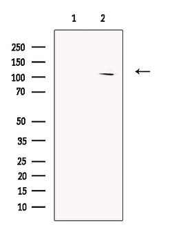 Invitrogen RECQL5 Polyclonal Antibody 100 &mu;L; Unconjugated:Antibodies,