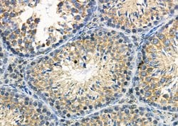 Invitrogen ATP6IP2 Polyclonal Antibody 100 &mu;L; Unconjugated:Antibodies,