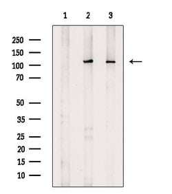 Invitrogen RB1 Polyclonal Antibody 100 &mu;L | Buy Online | Invitrogen&trade; | Fisher Scientific