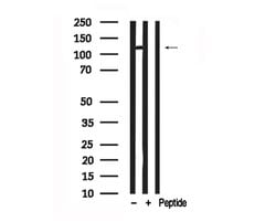 Invitrogen RB1 Polyclonal Antibody 100 &mu;L | Buy Online | Invitrogen&trade; | Fisher Scientific