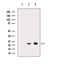 Invitrogen RHOA Polyclonal Antibody 100 &mu;L; Unconjugated:Antibodies,