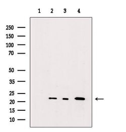 Invitrogen RHOA Polyclonal Antibody 100 &mu;L; Unconjugated:Antibodies,