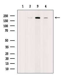 Invitrogen RICTOR Polyclonal Antibody 100 &mu;L; Unconjugated:Antibodies,