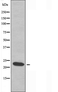 Invitrogen RPS9 Polyclonal Antibody 100 &mu;L; Unconjugated:Antibodies,