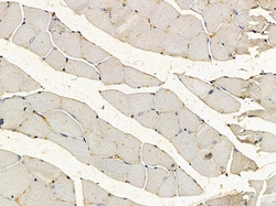 Invitrogen RyR1 Polyclonal Antibody 100 &mu;L; Unconjugated:Antibodies,