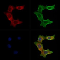 Invitrogen S100A3 Polyclonal Antibody 100 &mu;L | Buy Online | Invitrogen&trade; | Fisher Scientific