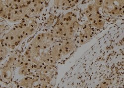 Invitrogen S100A3 Polyclonal Antibody 100 &mu;L | Buy Online | Invitrogen&trade; | Fisher Scientific