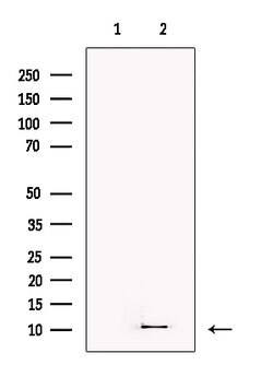 Invitrogen S100A3 Polyclonal Antibody 100 &mu;L | Buy Online | Invitrogen&trade; | Fisher Scientific