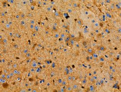 Invitrogen S100 Polyclonal Antibody 100 &mu;L; Unconjugated:Antibodies,