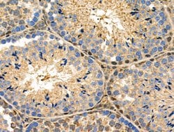 Invitrogen S100 Polyclonal Antibody 100 &mu;L; Unconjugated:Antibodies,