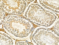 Invitrogen S100 Polyclonal Antibody 100 &mu;L; Unconjugated:Antibodies,