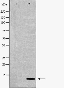 Invitrogen S100 Polyclonal Antibody 100 &mu;L; Unconjugated:Antibodies,