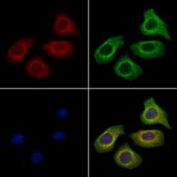 Invitrogen SAA4 Polyclonal Antibody 100 &mu;L; Unconjugated:Antibodies,