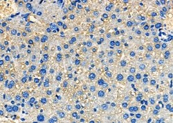 Invitrogen SAA4 Polyclonal Antibody 100 &mu;L; Unconjugated:Antibodies,
