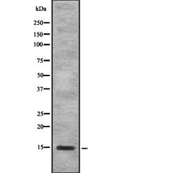 Invitrogen SAA4 Polyclonal Antibody 100 &mu;L; Unconjugated:Antibodies,