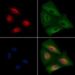 Invitrogen SALL1 Polyclonal Antibody 100 &mu;L; Unconjugated:Antibodies,