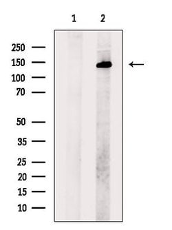 Invitrogen SALL1 Polyclonal Antibody 100 &mu;L; Unconjugated:Antibodies,
