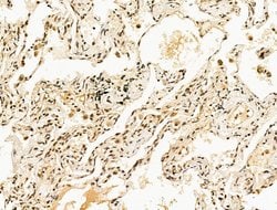 Invitrogen SF3B1 Polyclonal Antibody 100 &mu;L; Unconjugated:Antibodies,