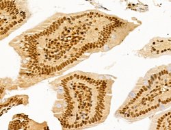 Invitrogen SF3B1 Polyclonal Antibody 100 &mu;L; Unconjugated:Antibodies,