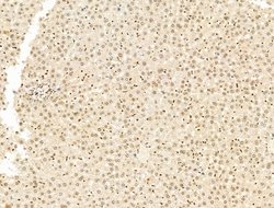 Invitrogen SF3B1 Polyclonal Antibody 100 &mu;L; Unconjugated:Antibodies,