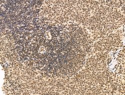 Invitrogen SF3B1 Polyclonal Antibody 100 &mu;L; Unconjugated:Antibodies,