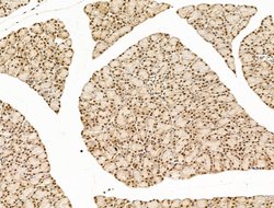 Invitrogen SF3B1 Polyclonal Antibody 100 &mu;L; Unconjugated:Antibodies,