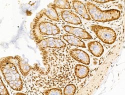 Invitrogen SF3B1 Polyclonal Antibody 100 &mu;L; Unconjugated:Antibodies,